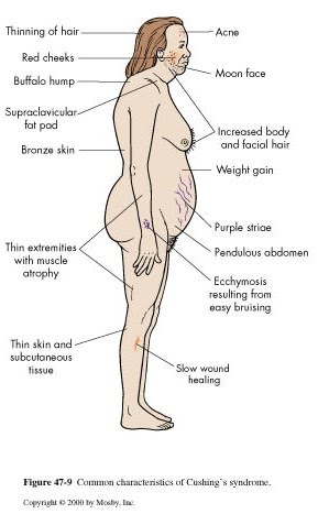 will 5mg prednisone cause weight gain