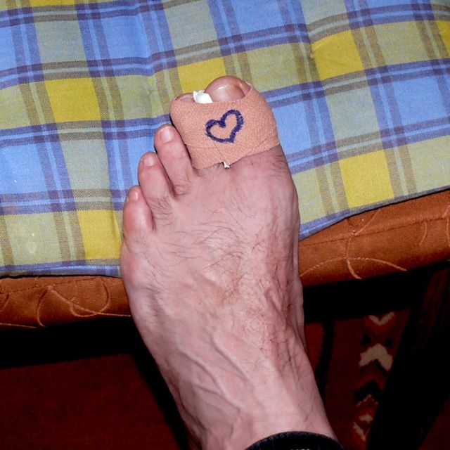 Big Toe Fracture Tales of Life in Mozambique-2.bp.blogspot.com