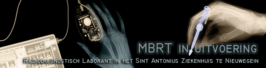 MBRT in uitvoering