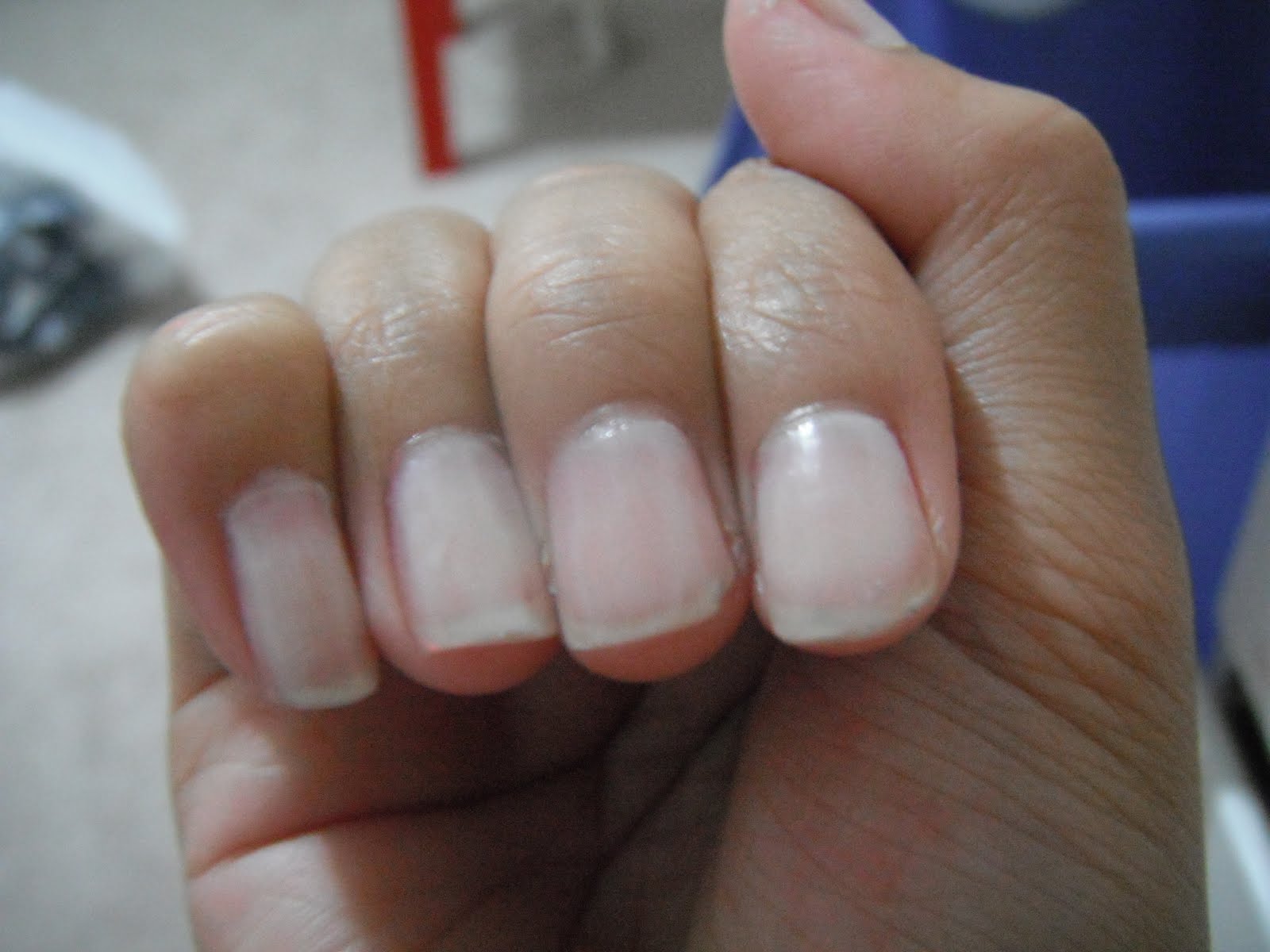 Nail Ridge Filler Nail Ftempo
