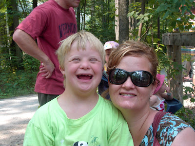 Chromosome 21 Trisomy