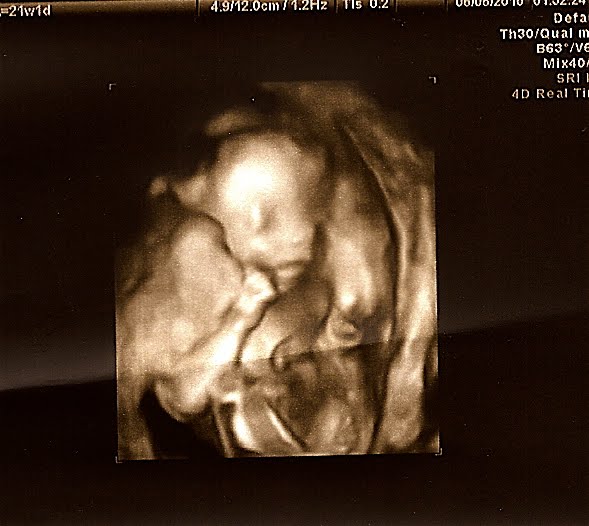 20 week 3d 20 week 3d