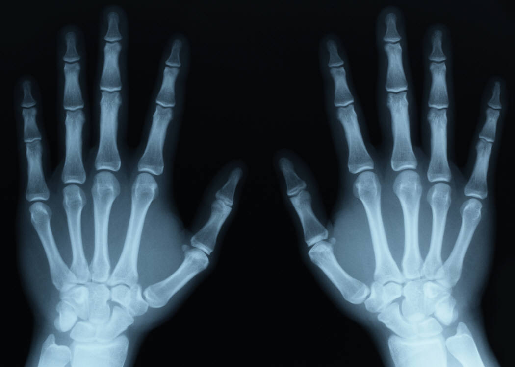 X-ray-hands.jpg