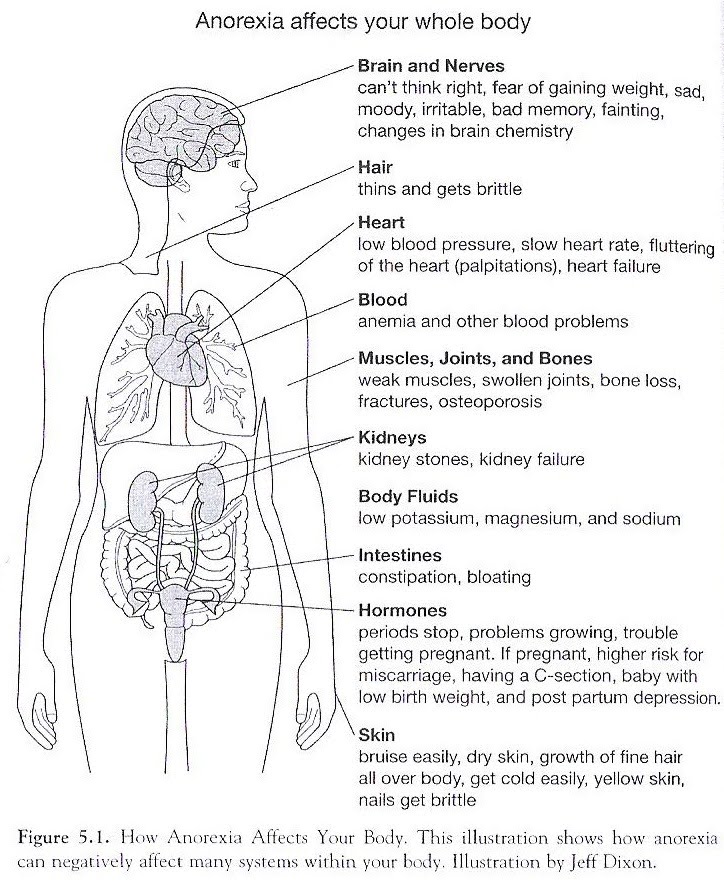 anorexia causes and effects