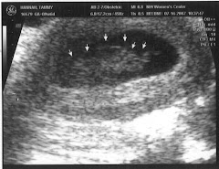 Week 10 Ultrasound