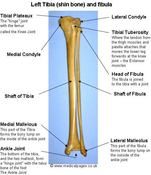 Tibia Bone Fracture