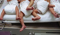 The feet of a set of quadruplets. A 55-year-old Indian woman has given birth to...