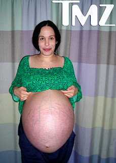 Nadya Suleman Nuts
