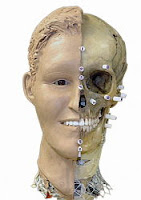 Image of a human skull half-covered with skin-depth offset markers, and half with a clay face sculpted onto it