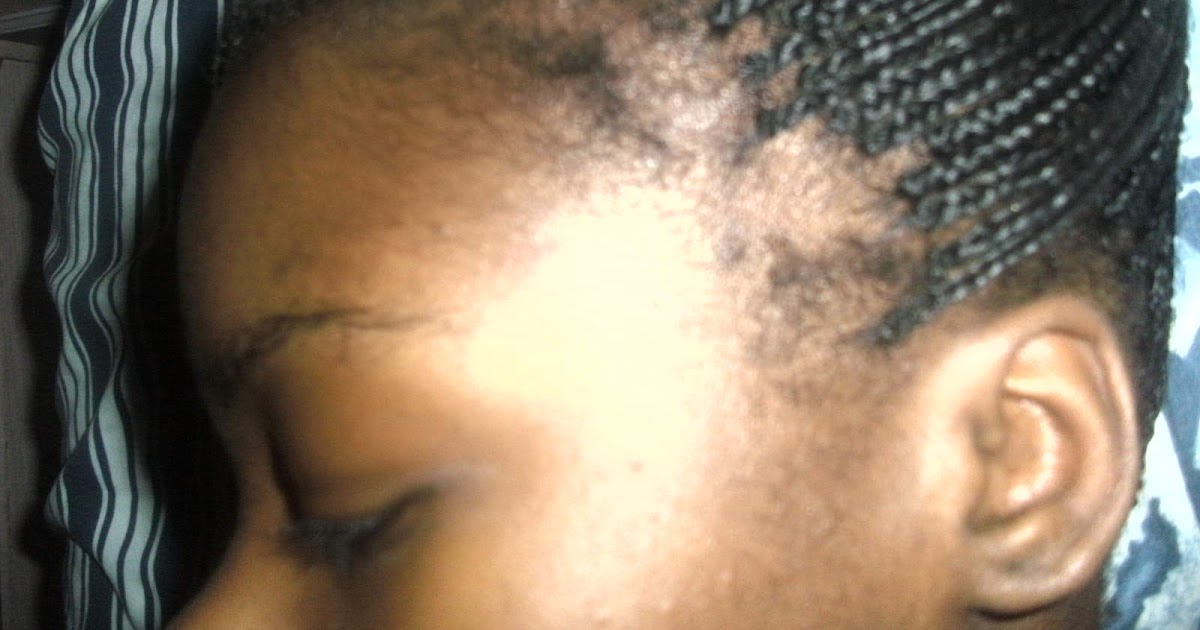 Sample Is Thinning Your Hair Good for Oval Face