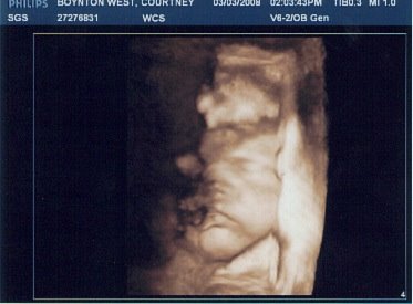 34 Week 3D Ultrasound