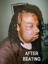 Jordan Miles, after the beating by Pittsburgh Police