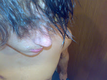 My Photo