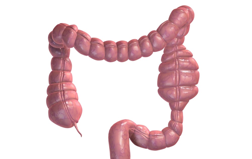 Blogging About Cystic Fibrosis (CF) Understanding Meconium Ileus