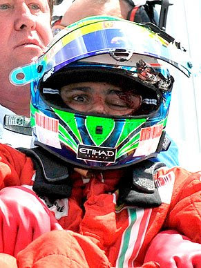 Felipe Massa e seu Capacete Destruído Felipe Massa e seu Capacete Destruído