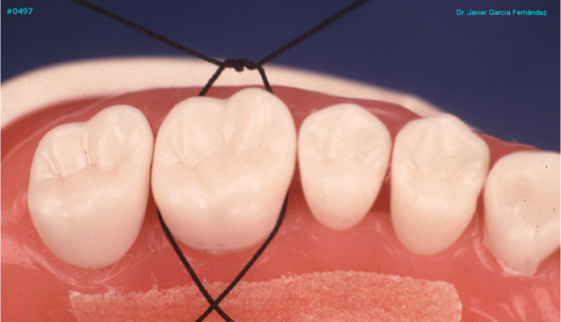 RxDentistry PERIODONTAL SUTURES.PPS