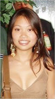 Traumatic Asphyxia Images