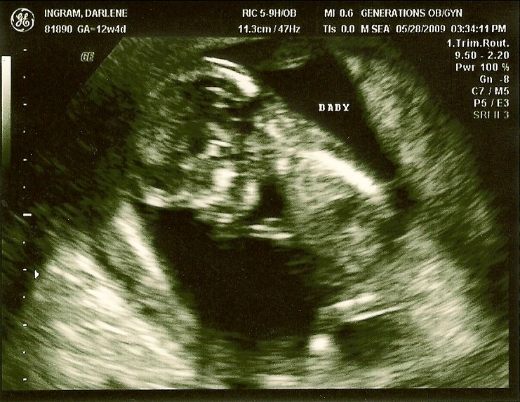 [Ultrasound+05-28-09.jpg]