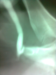ct ascending urethrogram