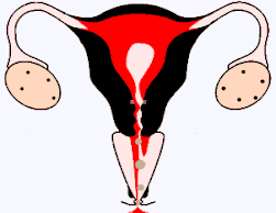 Menstruação
