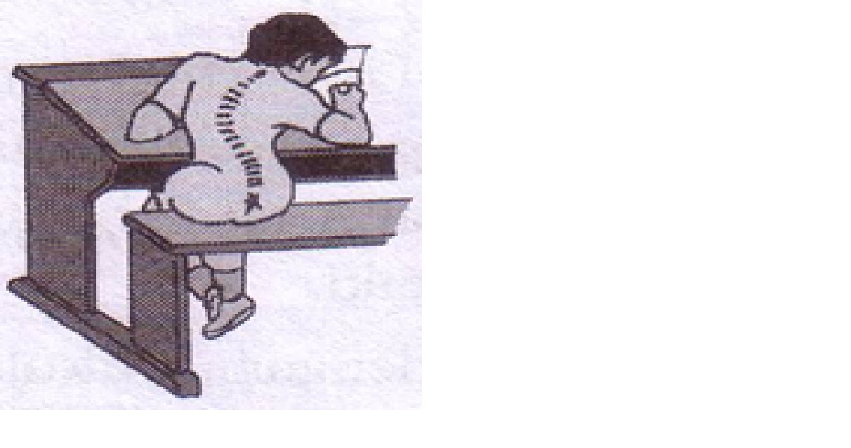 BIOLOGI (Anatomi Tubuh Manusia) Gangguan dan Kelainan BIOLOGI (Anatomi Tubuh Manusia) Gangguan dan Kelainan