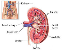 Nursing Diagnosis and Nursing Intervention for Chronic Renal Failure - CRF