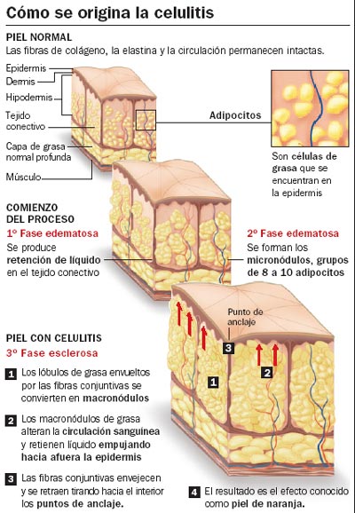 No comía después de seis y ha adelgazado en un mes