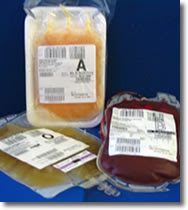 Blood Reactions To Transfusions