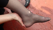 One for the broken leg and . (nancy broken leg close up)