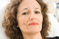 What To Consider Before Getting A Facelift