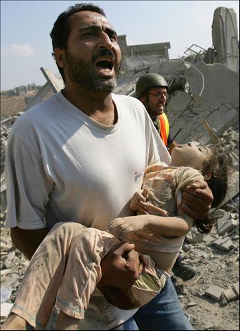 [child_injured_in_israeli_attack_on_the_gaza_strip__file_2007.jpg]