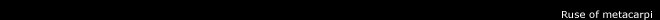 Ruse of Metacarpi