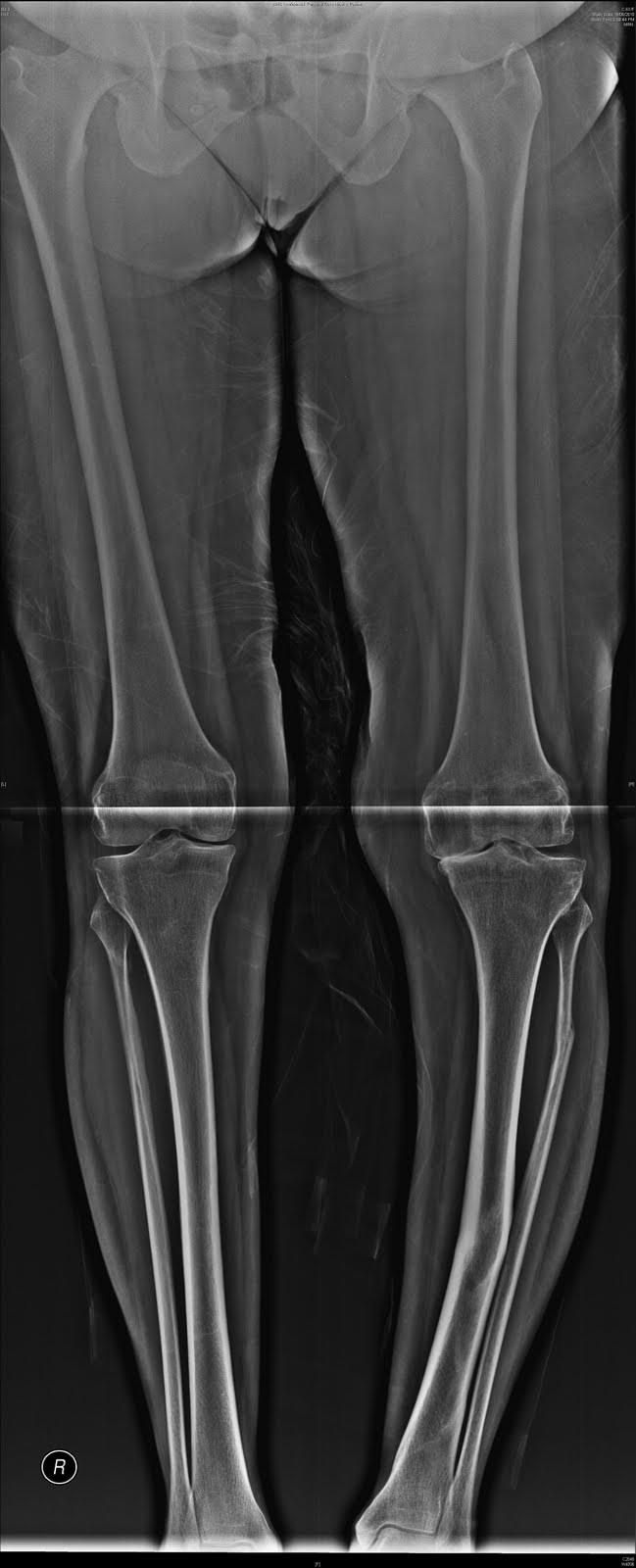 Animal 2 2008 CB01NEWS FILM GRATIS HD