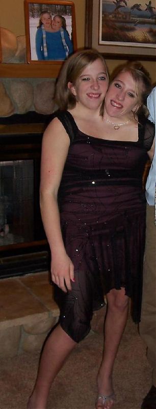 [siames_twins_07.jpg]