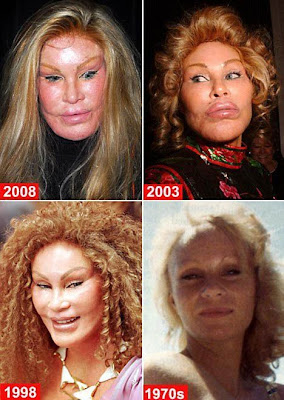 Plastic Surgery Game on Jocelyn Wildenstein  Catwoman Plastic Surgery Horror