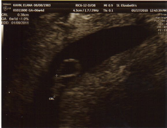 elana s musings who likes surprises the baby was only measuring 38cm 6w 0d but his her heartbeat was 132bpm i didn t cry when i had my first ultrasound with the twins even when i saw