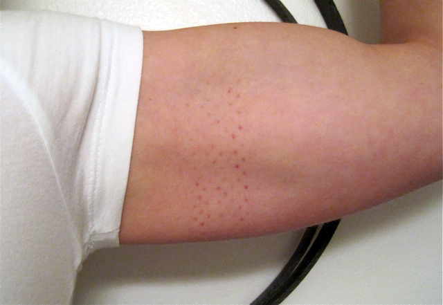 A Daily Dose of Fit The intenSATI Workout (and little red