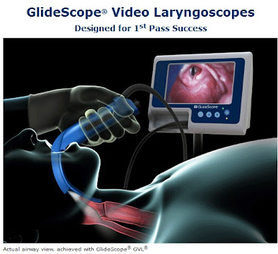 laryngoscopic view grade