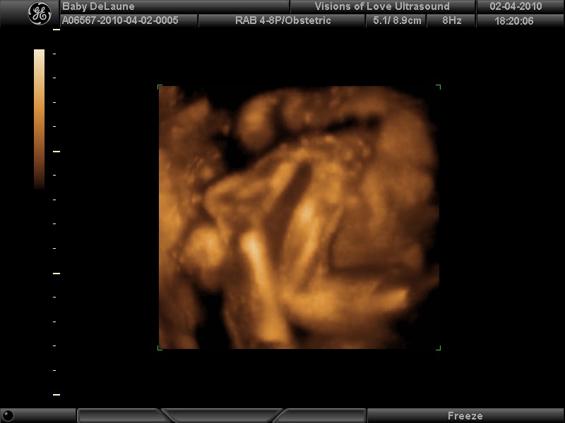 DeLaune Family 27 Week Sonogram