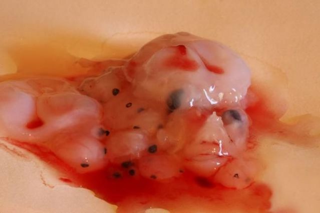 [abortion_12.jpg]