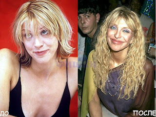 Courtney Love before and after plastic surgery photos