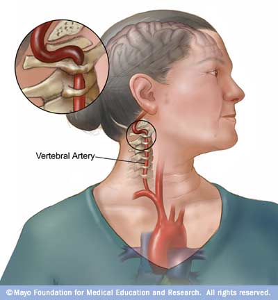 [ans7_bowhunter_stroke.jpg]