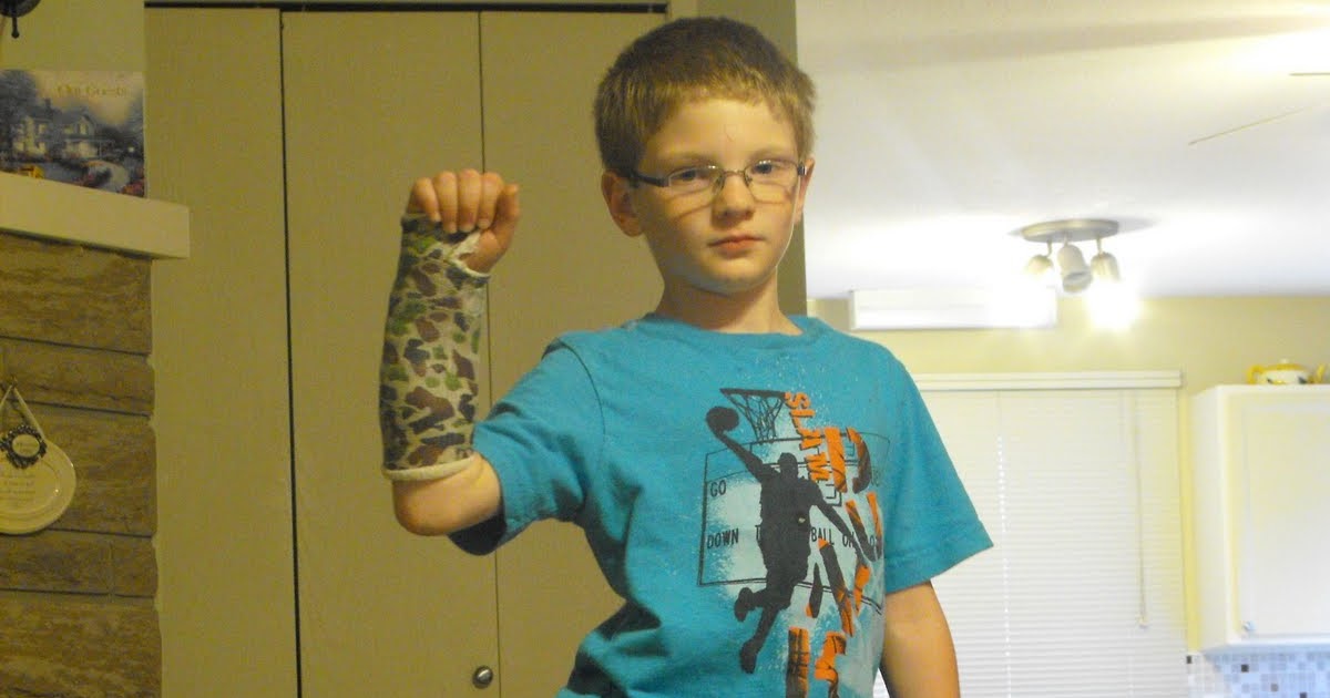 Morrow Memories Fiberglass cast at last!!