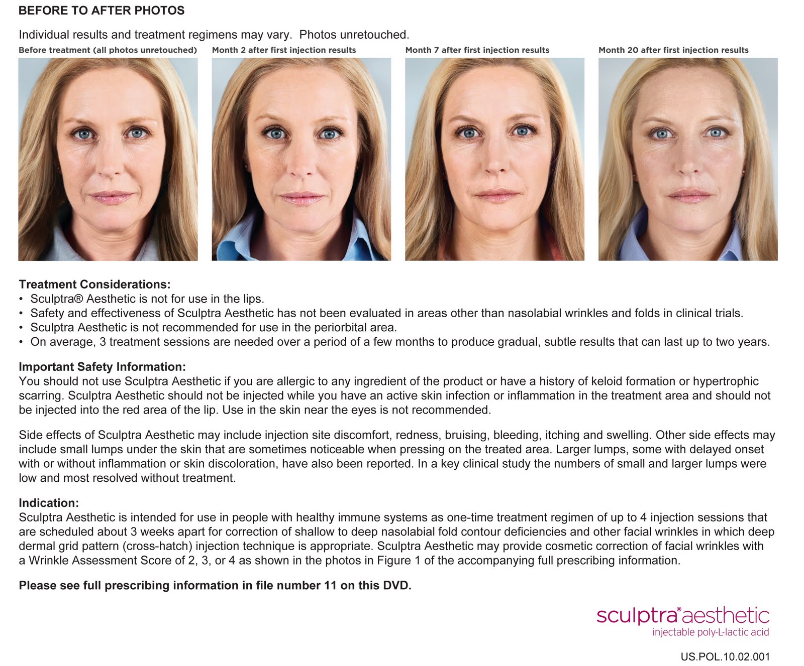 Aistheta Reno Medical Skin Care Center Sculptra Aesthetic