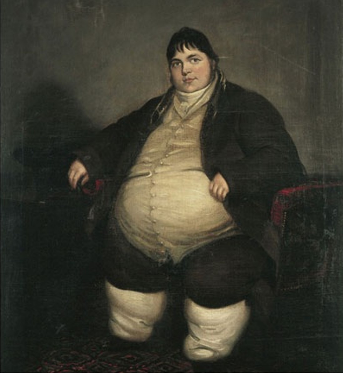 Losing Weight Ask Me How Morbid Obesity