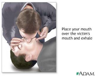 உயிர் காக்கும் முதலுதவி - எப்படி செய்ய வேண்டும் Mouth+to+mouth+resp