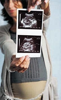 Laman Seri Mencari Keredhaan Mu Ramai Wanita Alami Hilang Kawalan Pundi Kencing