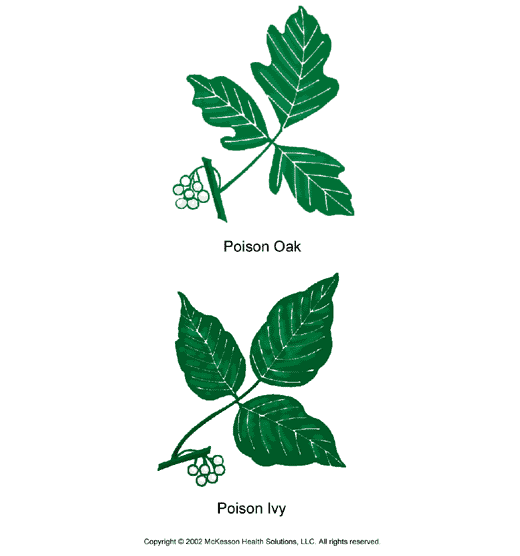 small poison oak rash. Poison ivy/oak is more common