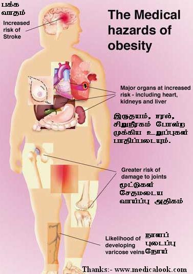 [obesity+complications+1.jpg]
