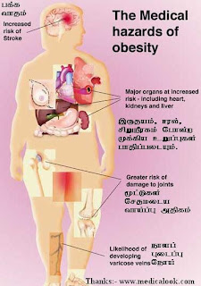 obesity+complications+1.jpg
